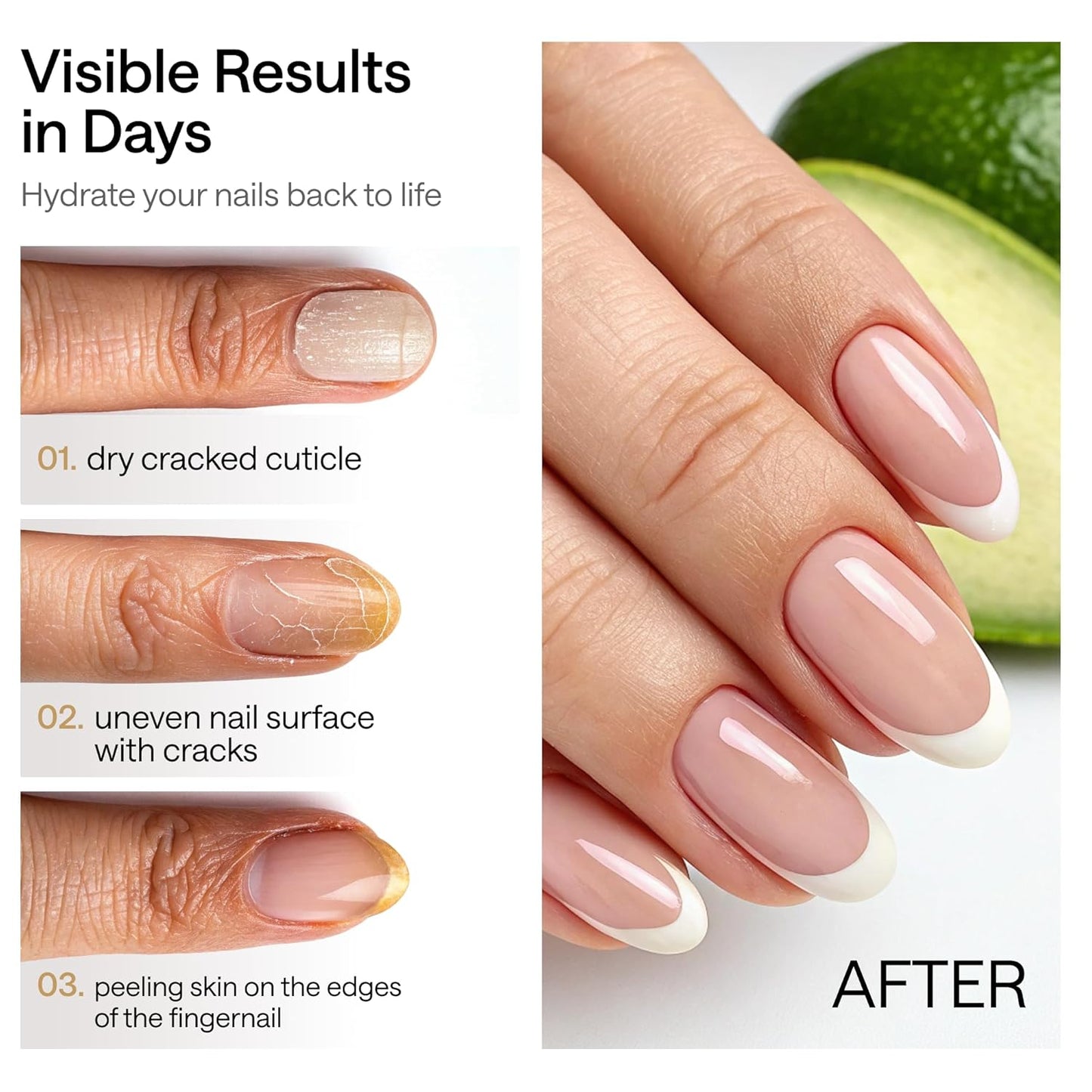 Nourishing Cuticle Oil Pen | Nail Growth, Strength & Cuticle Care